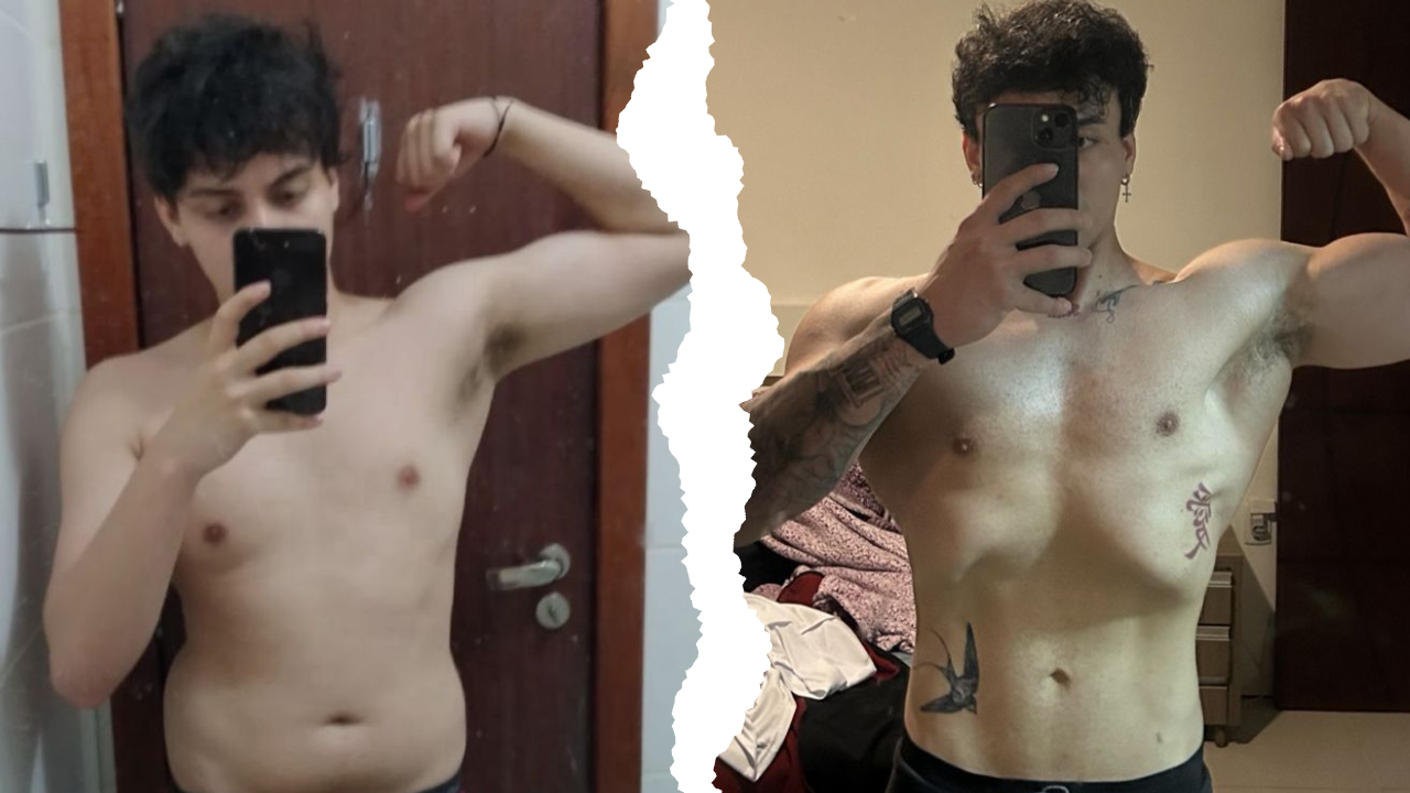 Antes e Depois Axel