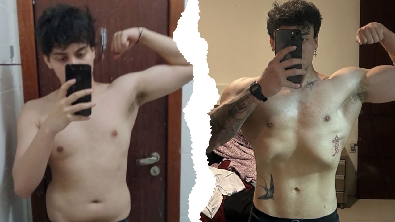 Antes e Depois Axel